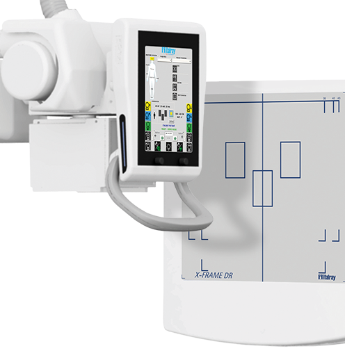 xframe-496x508_dettaglio